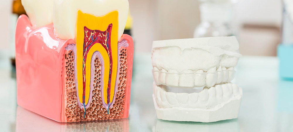 Elementos de ilustración para periodontitis