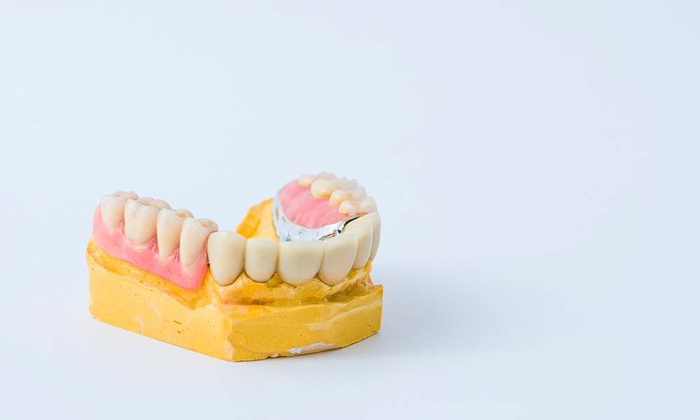 Modelo de prótesis dental