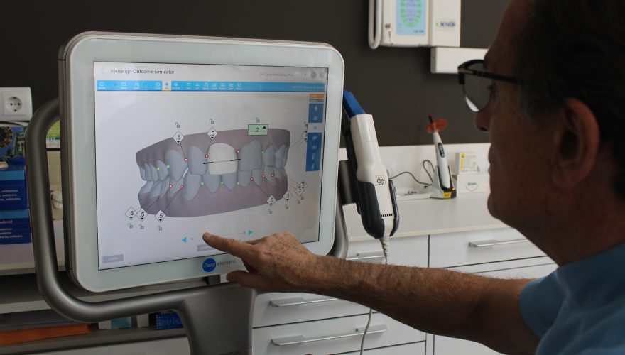 iTero: Avantatges de la tecnologia en l’odontologia